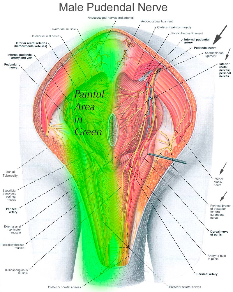 Trough, Folding Cushion for Tailbone Pain, Pelvic Pain, Genital Pain