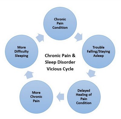 Chronic-Pain-Sleep-Cycle