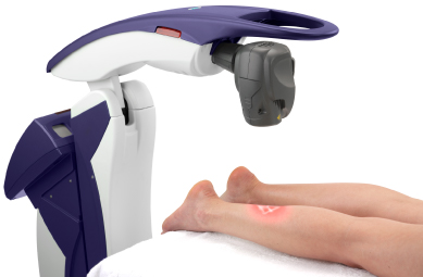 MLS laser therapy treatment example